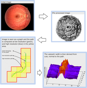 "Image processing: following blood vessels Following blood vessels